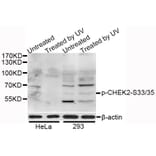 Western Blot - Anti-CHEK2 (phospho S33 + S35) Antibody (AP0545) - Antibodies.com