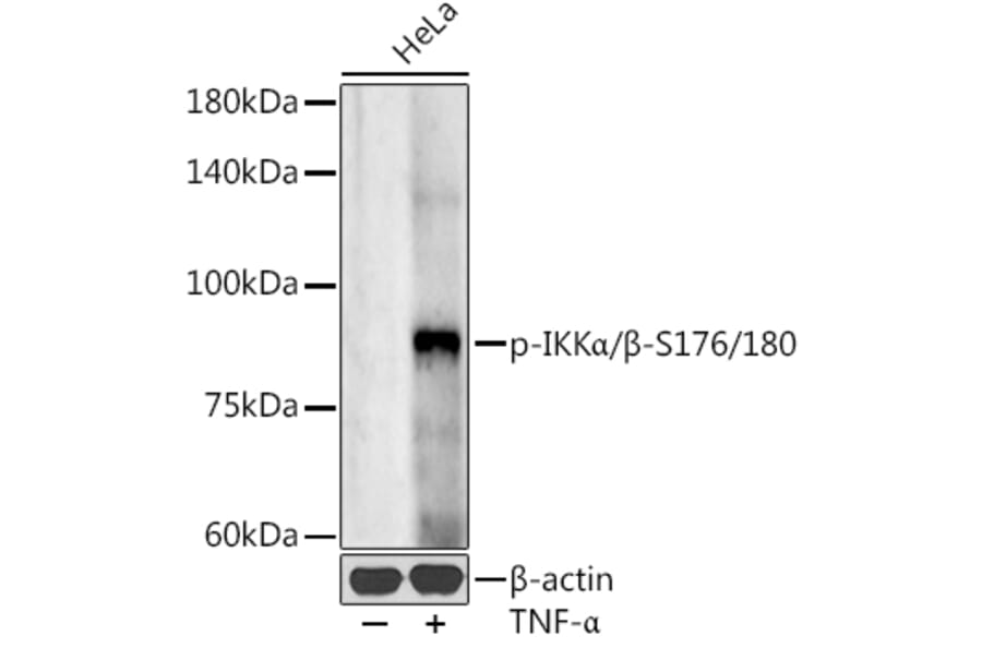 Western Blot - Anti-IKK alpha (Phospho S176/180) Antibody (A11024) - Antibodies.com