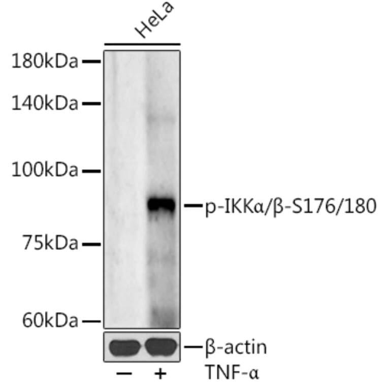 Western Blot - Anti-IKK alpha (Phospho S176/180) Antibody (A11024) - Antibodies.com