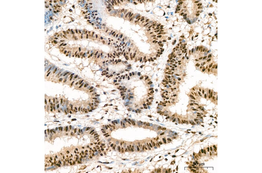 Immunohistochemistry - Anti-IKK alpha (Phospho S176/180) Antibody (A11024) - Antibodies.com
