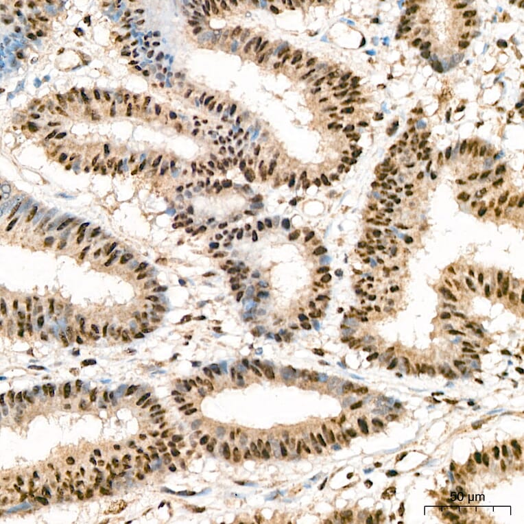 Immunohistochemistry - Anti-IKK alpha (Phospho S176/180) Antibody (A11024) - Antibodies.com