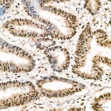 Immunohistochemistry - Anti-IKK alpha (Phospho S176/180) Antibody (A11024) - Antibodies.com