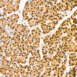 Immunohistochemistry - Anti-IKK alpha (Phospho S176/180) Antibody (A11024) - Antibodies.com