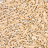 Immunohistochemistry - Anti-IKK alpha (Phospho S176/180) Antibody (A11024) - Antibodies.com