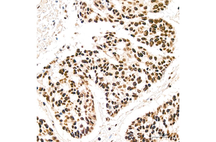 Immunohistochemistry - Anti-IKK alpha (Phospho S176/180) Antibody (A11024) - Antibodies.com
