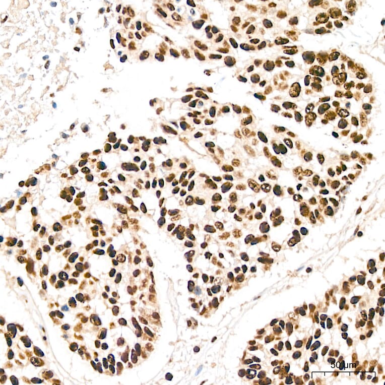 Immunohistochemistry - Anti-IKK alpha (Phospho S176/180) Antibody (A11024) - Antibodies.com