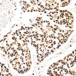 Immunohistochemistry - Anti-IKK alpha (Phospho S176/180) Antibody (A11024) - Antibodies.com