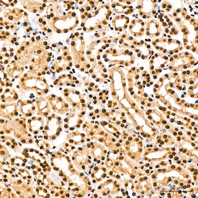 Immunohistochemistry - Anti-IKK alpha (Phospho S176/180) Antibody (A11024) - Antibodies.com