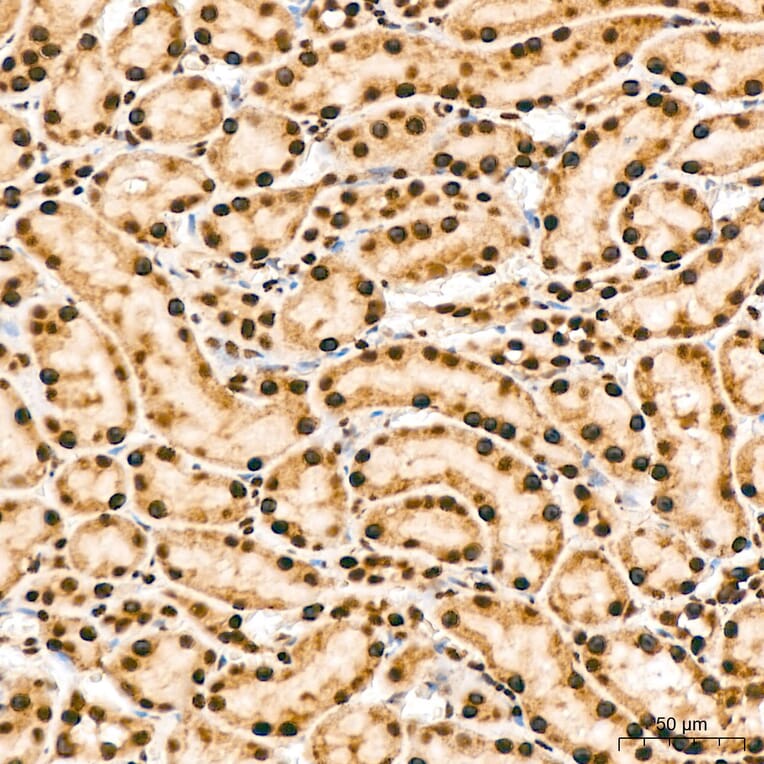 Immunohistochemistry - Anti-IKK alpha (Phospho S176/180) Antibody (A11024) - Antibodies.com