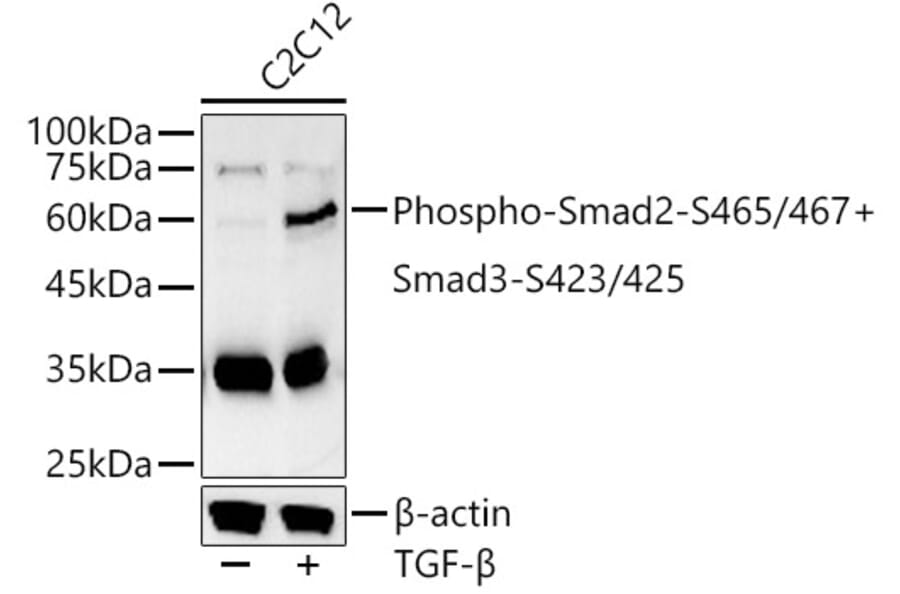 Western Blot - Anti-Smad2 (phospho Ser465 + Ser467) + Smad3 (phospho Ser423 + Ser425) Antibody (A11026) - Antibodies.com