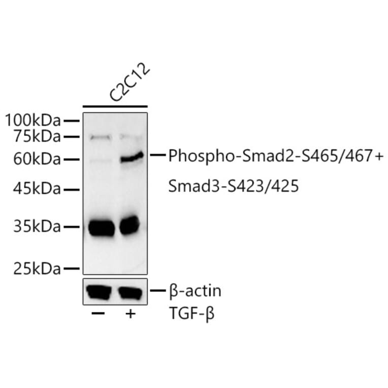 Western Blot - Anti-Smad2 (phospho Ser465 + Ser467) + Smad3 (phospho Ser423 + Ser425) Antibody (A11026) - Antibodies.com