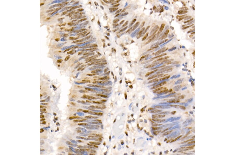 Immunohistochemistry - Anti-Smad2 (phospho Ser465 + Ser467) + Smad3 (phospho Ser423 + Ser425) Antibody (A11026) - Antibodies.com