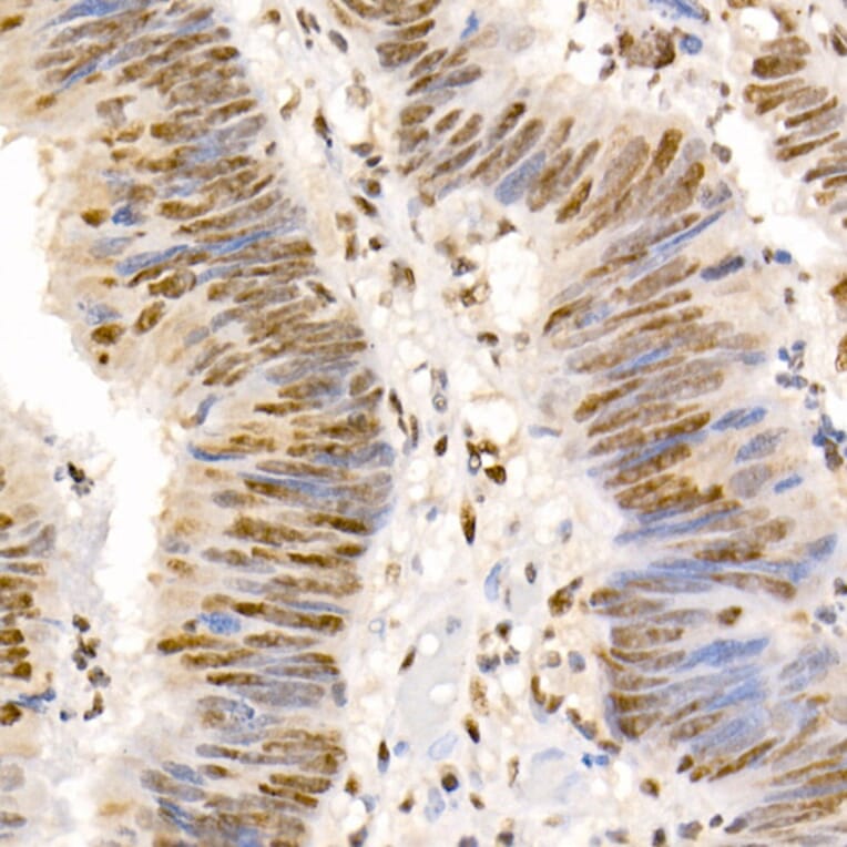 Immunohistochemistry - Anti-Smad2 (phospho Ser465 + Ser467) + Smad3 (phospho Ser423 + Ser425) Antibody (A11026) - Antibodies.com