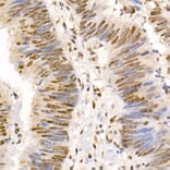 Immunohistochemistry - Anti-Smad2 (phospho Ser465 + Ser467) + Smad3 (phospho Ser423 + Ser425) Antibody (A11026) - Antibodies.com