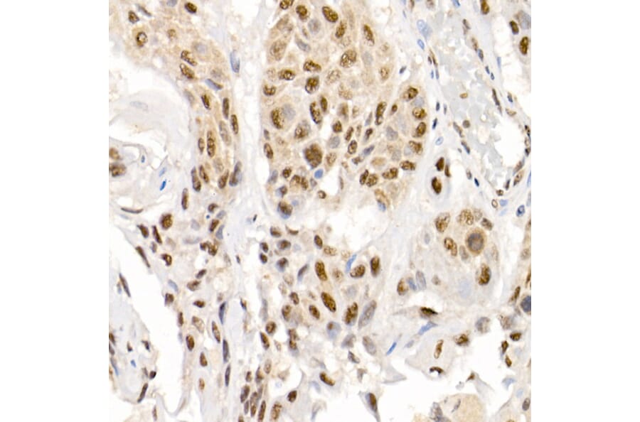 Immunohistochemistry - Anti-Smad2 (phospho Ser465 + Ser467) + Smad3 (phospho Ser423 + Ser425) Antibody (A11026) - Antibodies.com