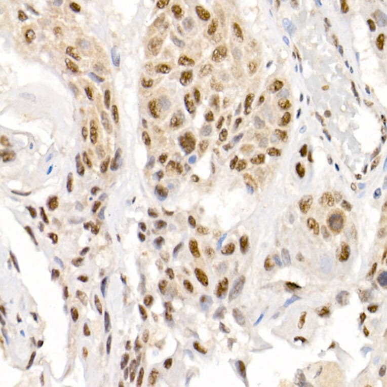Immunohistochemistry - Anti-Smad2 (phospho Ser465 + Ser467) + Smad3 (phospho Ser423 + Ser425) Antibody (A11026) - Antibodies.com