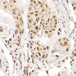 Immunohistochemistry - Anti-Smad2 (phospho Ser465 + Ser467) + Smad3 (phospho Ser423 + Ser425) Antibody (A11026) - Antibodies.com