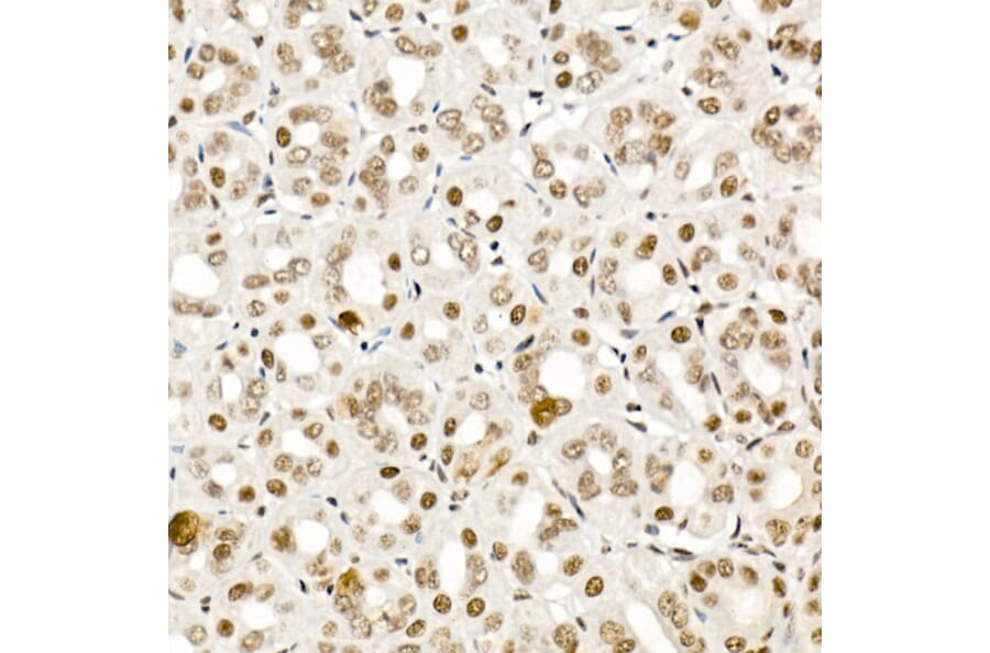 Immunohistochemistry - Anti-Smad2 (phospho Ser465 + Ser467) + Smad3 (phospho Ser423 + Ser425) Antibody (A11026) - Antibodies.com