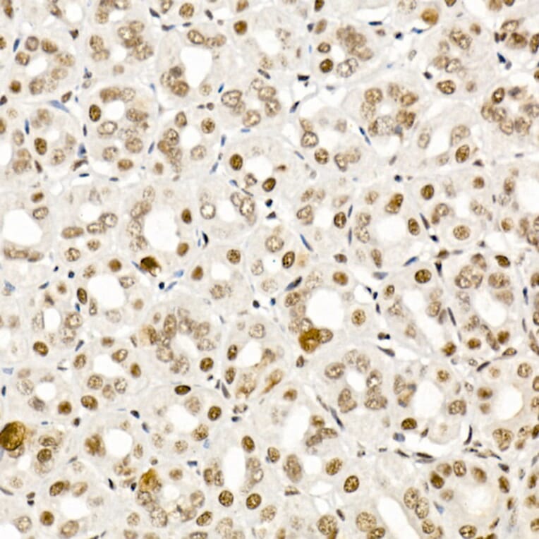 Immunohistochemistry - Anti-Smad2 (phospho Ser465 + Ser467) + Smad3 (phospho Ser423 + Ser425) Antibody (A11026) - Antibodies.com