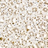Immunohistochemistry - Anti-Smad2 (phospho Ser465 + Ser467) + Smad3 (phospho Ser423 + Ser425) Antibody (A11026) - Antibodies.com