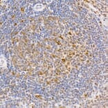 Immunohistochemistry - Anti-Smad2 (phospho Ser465 + Ser467) + Smad3 (phospho Ser423 + Ser425) Antibody (A11026) - Antibodies.com