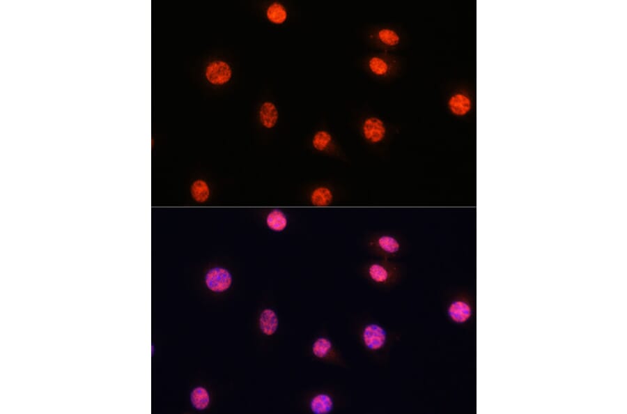 Immunofluorescence - Anti-Smad2 (phospho Ser465 + Ser467) + Smad3 (phospho Ser423 + Ser425) Antibody (A11026) - Antibodies.com