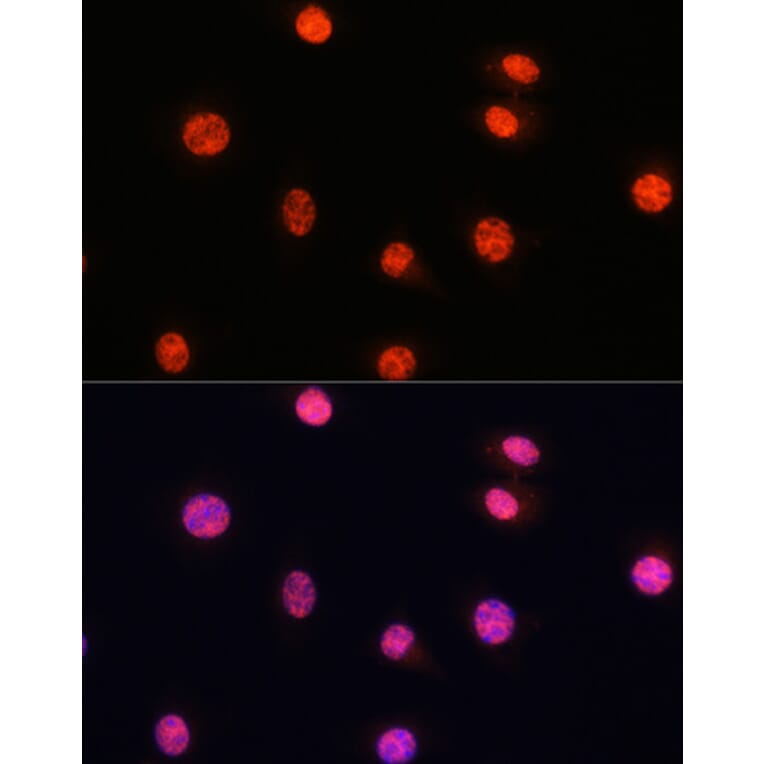 Immunofluorescence - Anti-Smad2 (phospho Ser465 + Ser467) + Smad3 (phospho Ser423 + Ser425) Antibody (A11026) - Antibodies.com