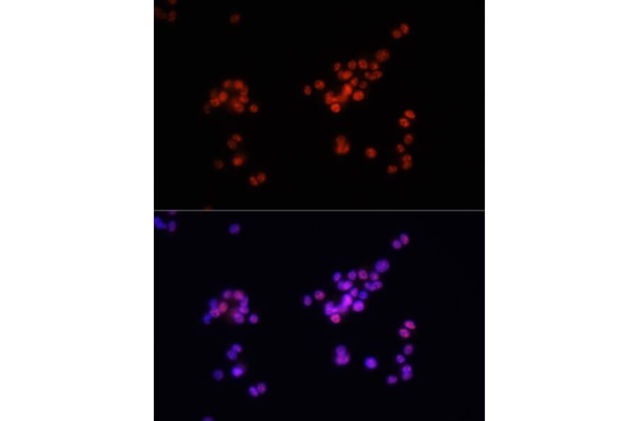 Immunofluorescence - Anti-Smad2 (phospho Ser465 + Ser467) + Smad3 (phospho Ser423 + Ser425) Antibody (A11026) - Antibodies.com