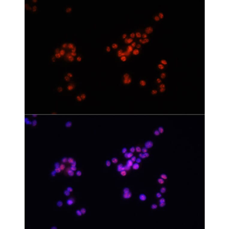Immunofluorescence - Anti-Smad2 (phospho Ser465 + Ser467) + Smad3 (phospho Ser423 + Ser425) Antibody (A11026) - Antibodies.com