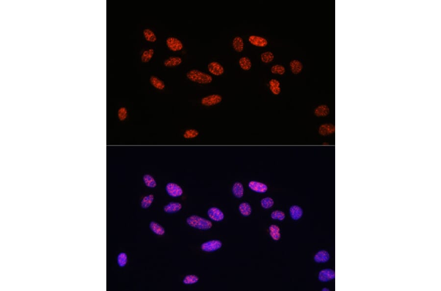 Immunofluorescence - Anti-Smad2 (phospho Ser465 + Ser467) + Smad3 (phospho Ser423 + Ser425) Antibody (A11026) - Antibodies.com