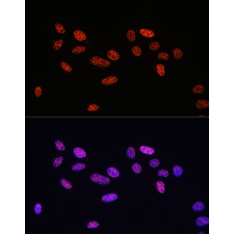 Immunofluorescence - Anti-Smad2 (phospho Ser465 + Ser467) + Smad3 (phospho Ser423 + Ser425) Antibody (A11026) - Antibodies.com