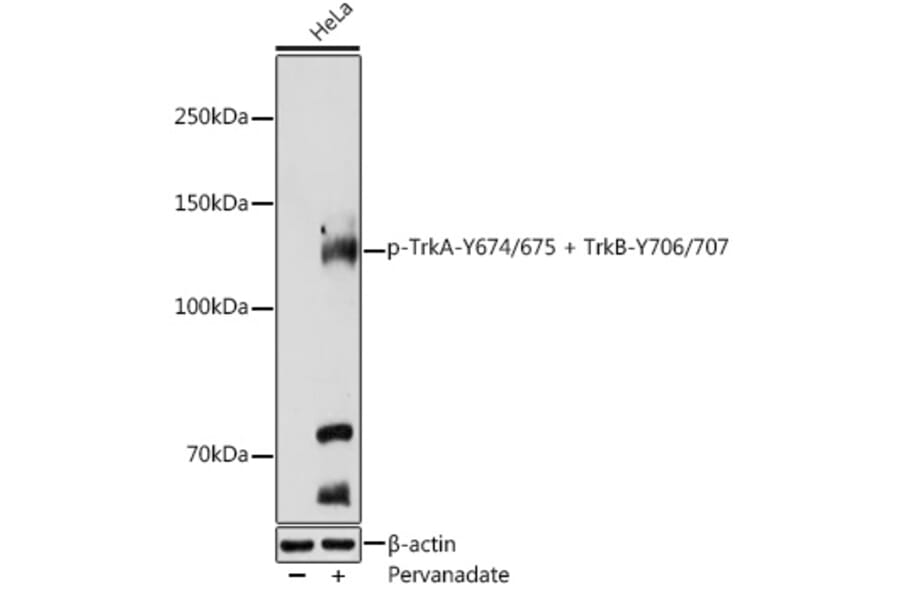 Western Blot - Anti-TrkA (phospho Tyr674 + Tyr675) + TrkB (phospho Tyr706 + Tyr707) Antibody (A11027) - Antibodies.com