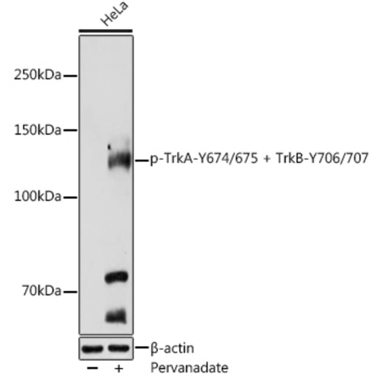 Western Blot - Anti-TrkA (phospho Tyr674 + Tyr675) + TrkB (phospho Tyr706 + Tyr707) Antibody (A11027) - Antibodies.com