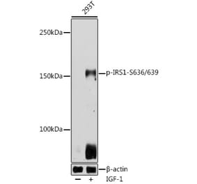 Western Blot - Anti-IRS1 (phospho Ser636 + Ser639) Antibody (A11029) - Antibodies.com