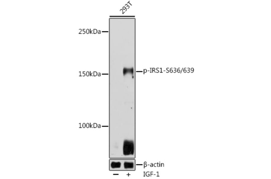 Western Blot - Anti-IRS1 (phospho Ser636 + Ser639) Antibody (A11029) - Antibodies.com