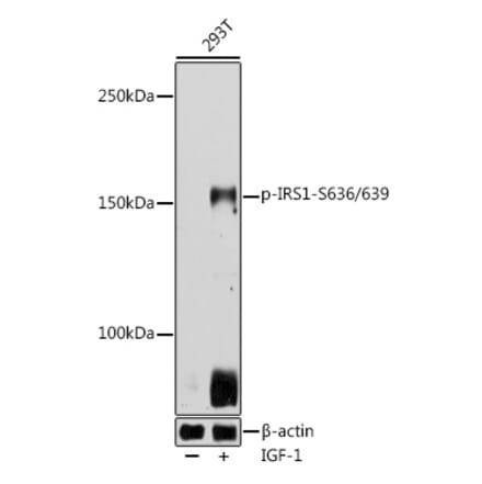 Western Blot - Anti-IRS1 (phospho Ser636 + Ser639) Antibody (A11029) - Antibodies.com