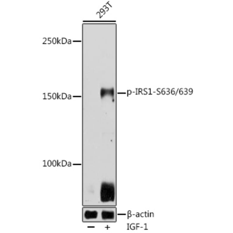 Western Blot - Anti-IRS1 (phospho Ser636 + Ser639) Antibody (A11029) - Antibodies.com