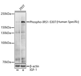 Western Blot - Anti-IRS1 (phospho Ser307) Antibody (A11030) - Antibodies.com