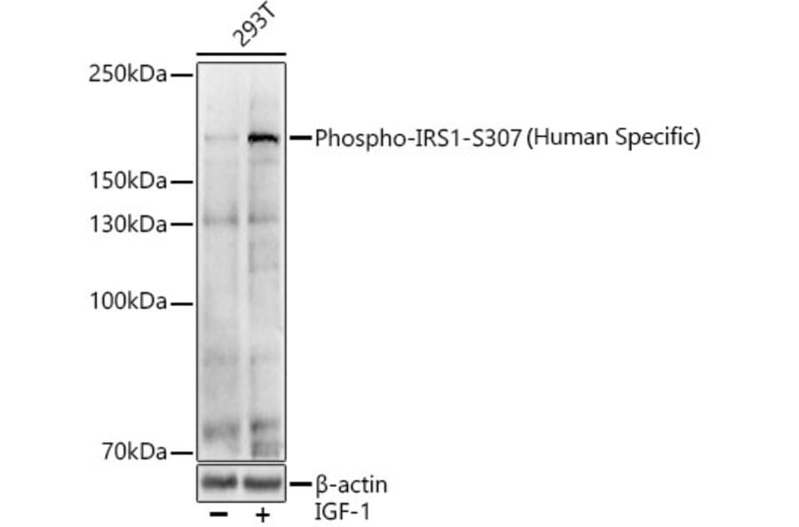 Western Blot - Anti-IRS1 (phospho Ser307) Antibody (A11030) - Antibodies.com