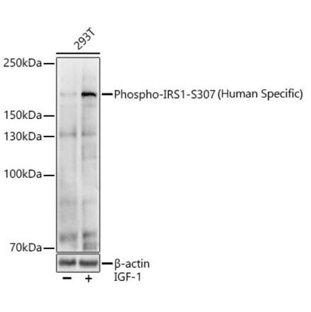 Western Blot - Anti-IRS1 (phospho Ser307) Antibody (A11030) - Antibodies.com