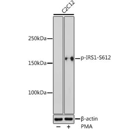 Western Blot - Anti-IRS1 (phospho Ser612) Antibody (A11031) - Antibodies.com