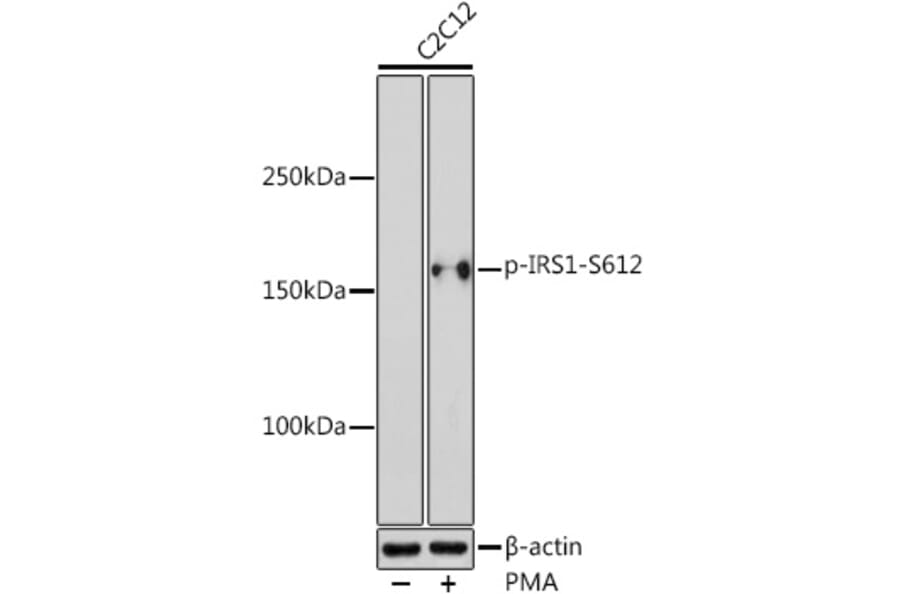 Western Blot - Anti-IRS1 (phospho Ser612) Antibody (A11031) - Antibodies.com