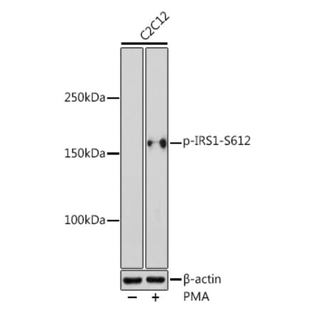 Western Blot - Anti-IRS1 (phospho Ser612) Antibody (A11031) - Antibodies.com