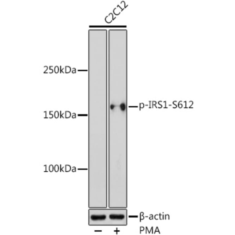 Western Blot - Anti-IRS1 (phospho Ser612) Antibody (A11031) - Antibodies.com