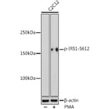 Western Blot - Anti-IRS1 (phospho Ser612) Antibody (A11031) - Antibodies.com