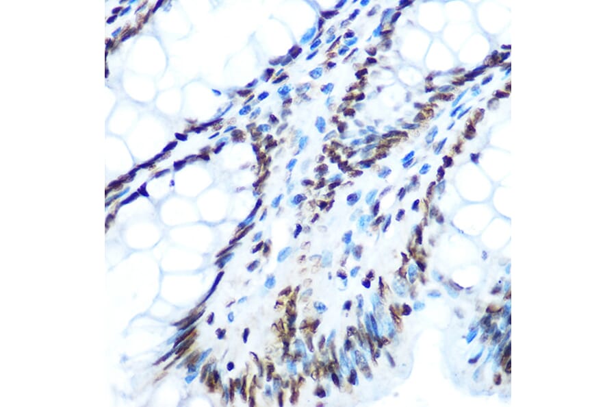 Immunohistochemistry - Anti-IRS1 (phospho Ser612) Antibody (A11031) - Antibodies.com