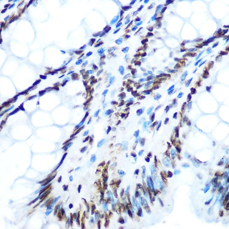 Immunohistochemistry - Anti-IRS1 (phospho Ser612) Antibody (A11031) - Antibodies.com