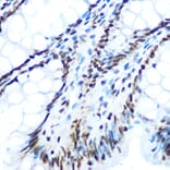 Immunohistochemistry - Anti-IRS1 (phospho Ser612) Antibody (A11031) - Antibodies.com