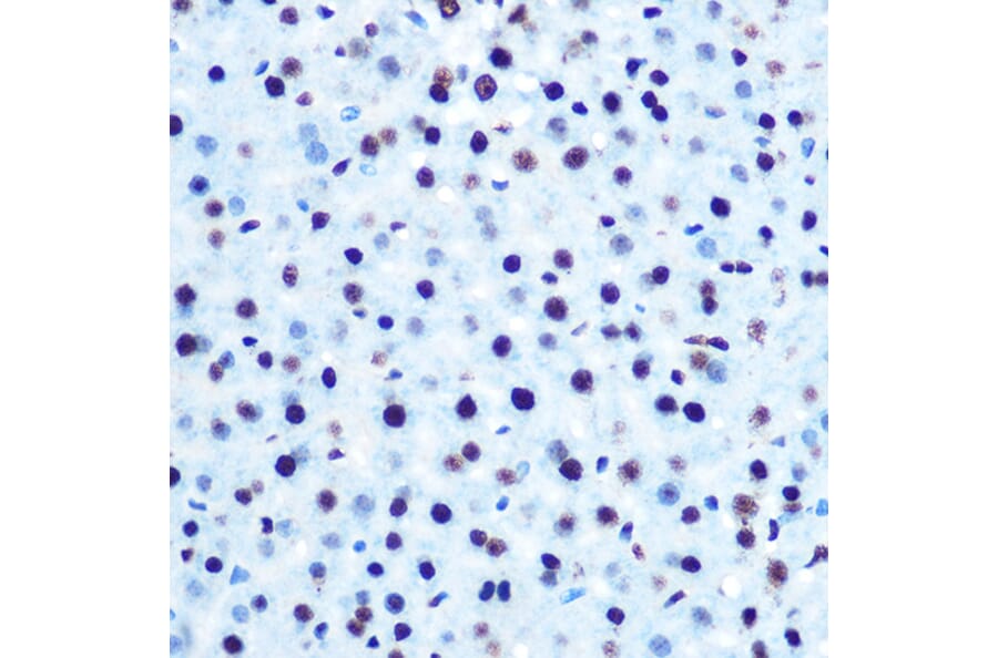 Immunohistochemistry - Anti-IRS1 (phospho Ser612) Antibody (A11031) - Antibodies.com