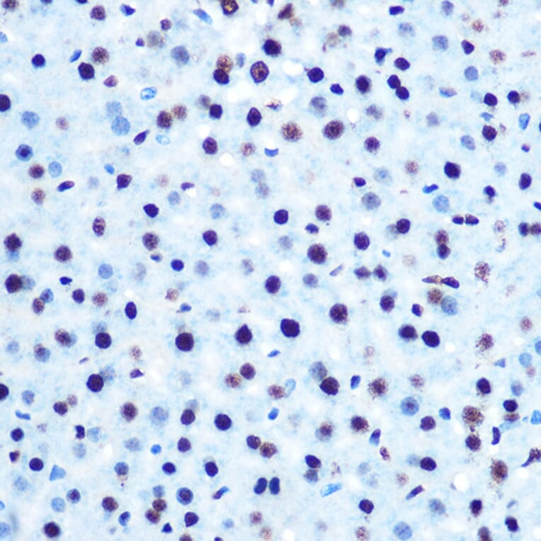 Immunohistochemistry - Anti-IRS1 (phospho Ser612) Antibody (A11031) - Antibodies.com